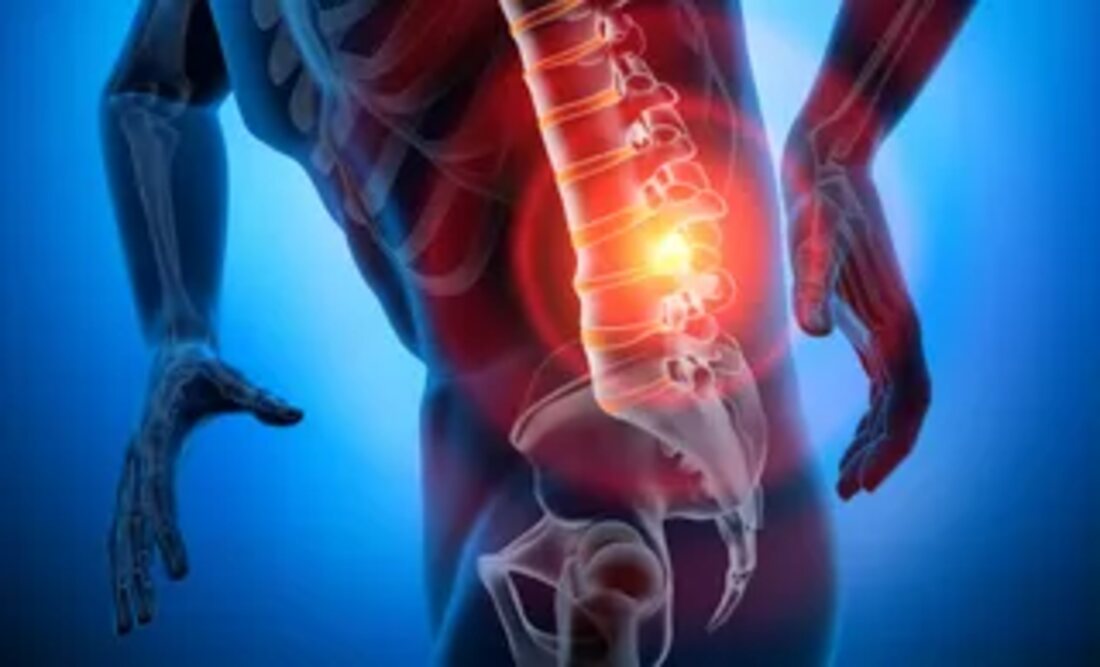 An illustration of the lumbar spine, with the painful segment highlighted